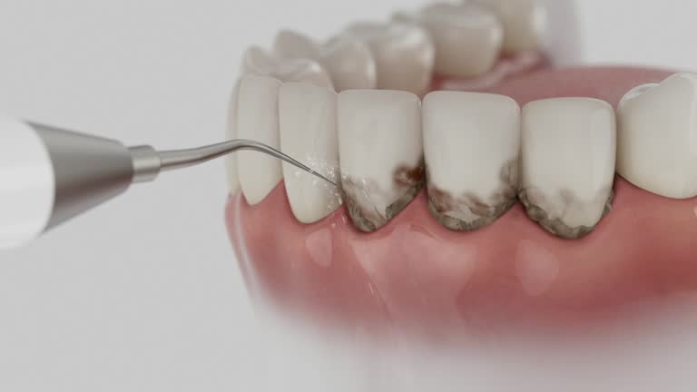 Reliable Dental contractor in Coldwater, MI by Dentist Open Now